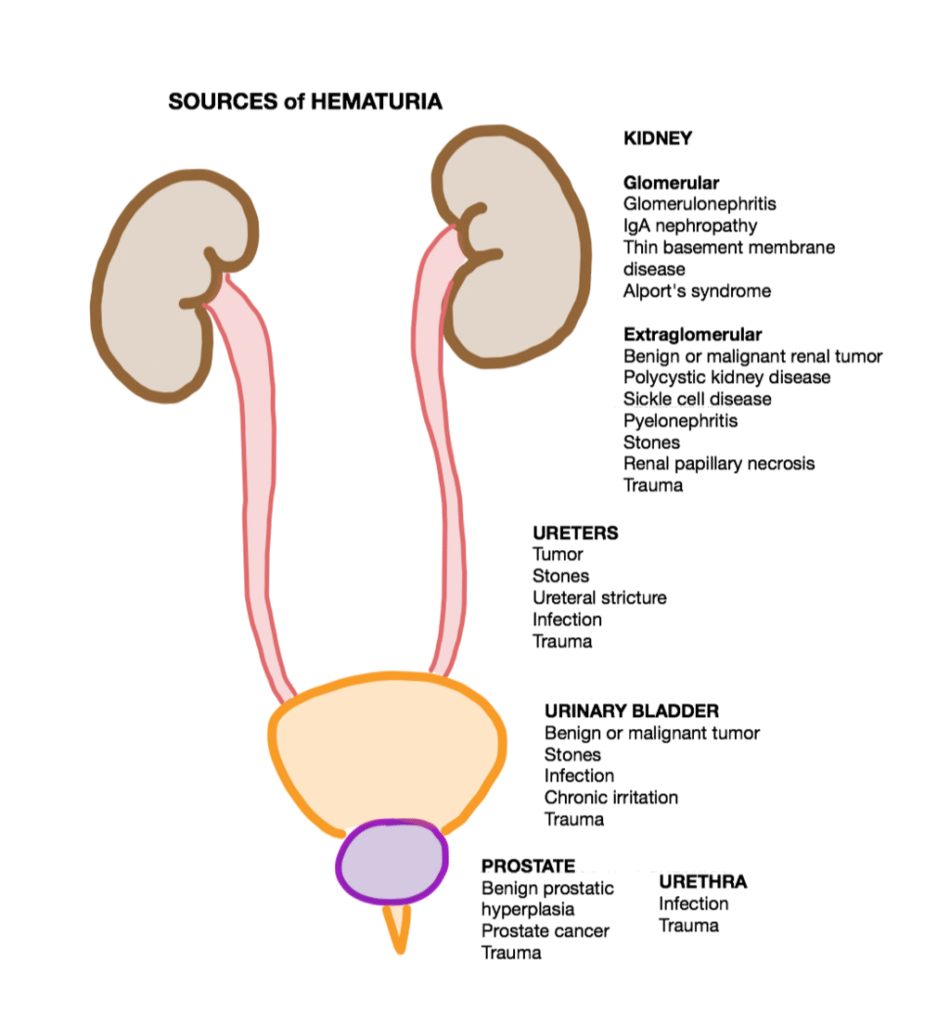Sources_of_Hematuria_by_Anatomic_Location